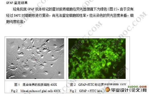 小鼠星状胶质细胞体外培养及鉴定