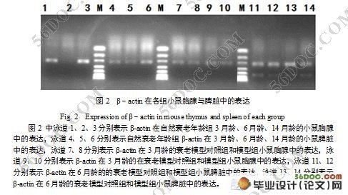 ϸSOCS3Gfi-1IL-2Gadd45Bcl2С˥Ϲеת¼о